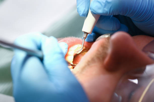 Best Emergency Treatment for Toothache in Lancaster, KY