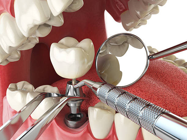 Best Walk-In Emergency Dentist in Lancaster, KY